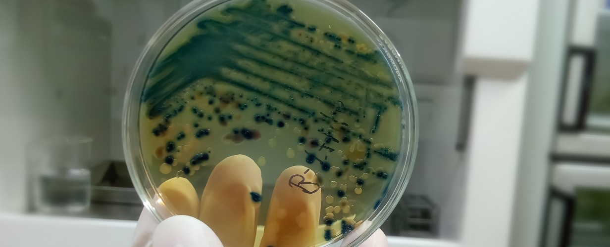 Эпидемиолог рассказал о невозможности тотальной устойчивости микроорганизмов к антибиотикам 